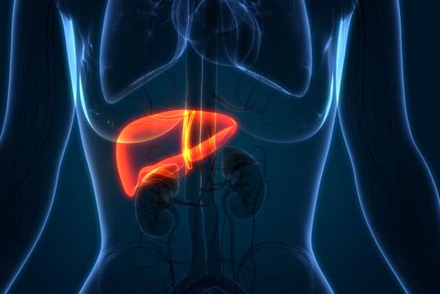 What is liver cancer and what causes it?
