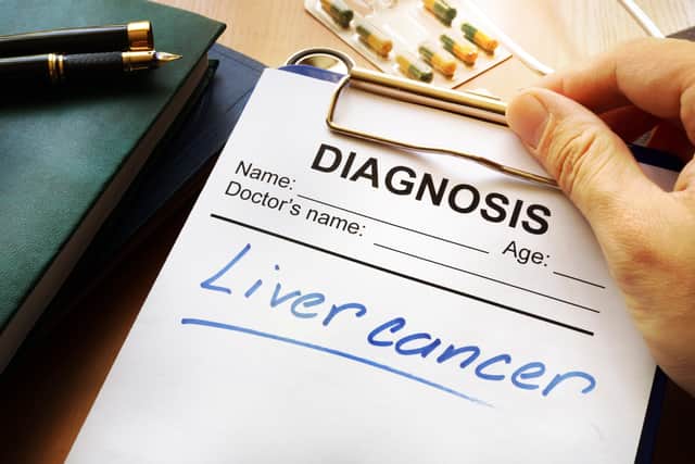 How is it diagnosed?