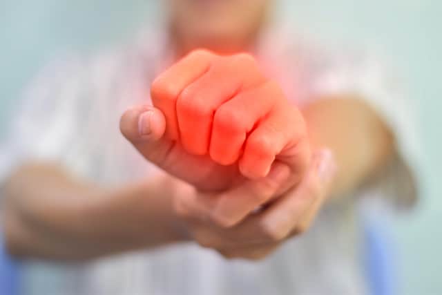 What factors may exacerbate arthritis symptoms in the summer?