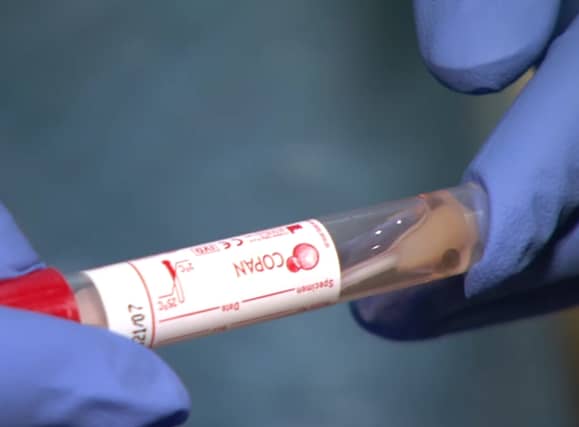Coronavirus Covid-19 testing has reached 1,000