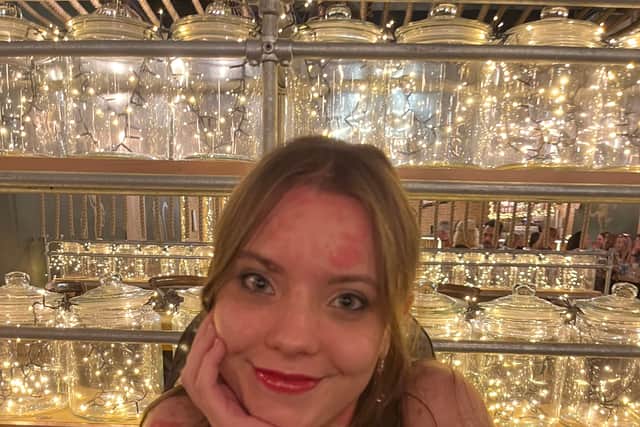 Molly Matthews: “I love my skin much more than before”
