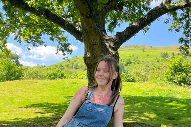 “I also constantly find myself feeling guilty about leaving copious amounts of my skin everywhere – from desks to Ubers to restaurants. It’s just something you have to get used to being a part of your life.”