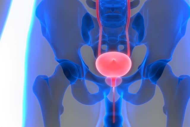 “The balance of hormones (oestrogen and testosterone) in your body changes as you get older. This may cause your prostate to grow,” Prostate Cancer UK notes.