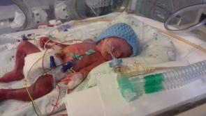 Brave Midlands boy ready to celebrate his second birthday