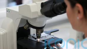 First case of monkeypox identified in Ireland, Health Service Executive says