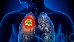 Lung Cancer Awareness Month: Myths about lung cancer everyone needs to stop believing