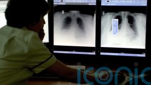 AI to be used more widely in NHS hospitals