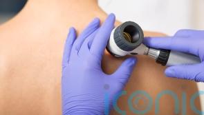 Skin cancer cases reach record high – how to spot the signs