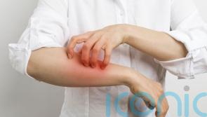 What is scabies and how do you get it?