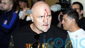 Tyson Fury’s father John suffers cut to head as Oleksandr Usyk fight week begins