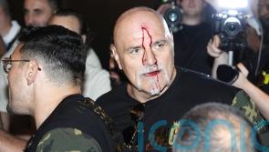 Tyson Fury’s father John cut after clash with member of Oleksandr Usyk entourage