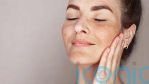 Why does the sun give me hyperpigmentation and what can I do about it?