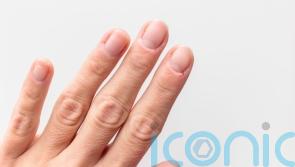 How to stop dry and cracked cuticles