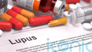 What is lupus and what are the symptoms?