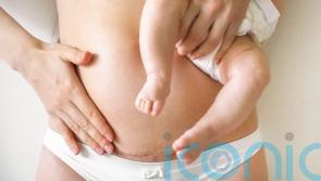 5 myths and misconceptions about caesareans everyone needs to stop believing