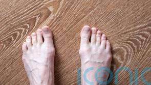 8 things your feet can tell you about your health