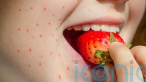 8 signs of food allergies in children you might not know