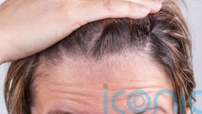 Why your hair is thinning and how to fix it