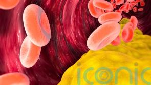 The truth about cholesterol – what you need to know