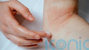 Best psoriasis-friendly skincare routine