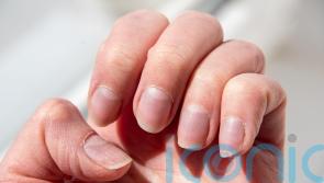 What the look of your nails says about your health
