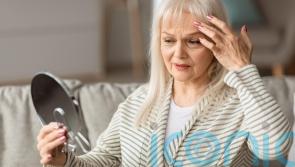 How to cover signs of festive fatigue