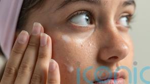 How to get rid of &lsquo;milk spots&rsquo;