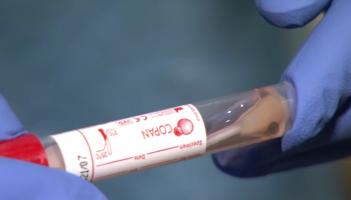 7,203 people suffering with Long Covid condition in Tipperary