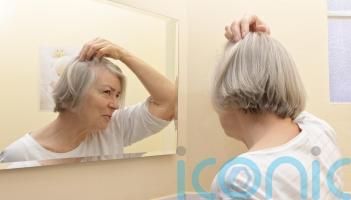 5 reasons you may be losing your hair and how to prevent it