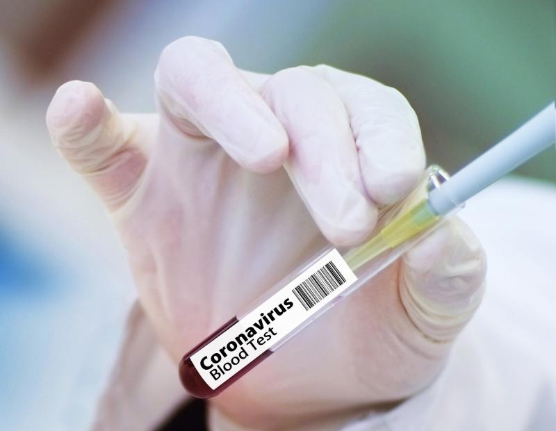 Hundreds left without Covid-19 test as facilities run out of testing kits 