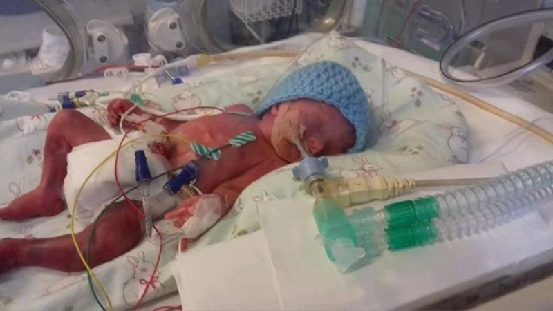 Brave Midlands boy ready to celebrate his second birthday