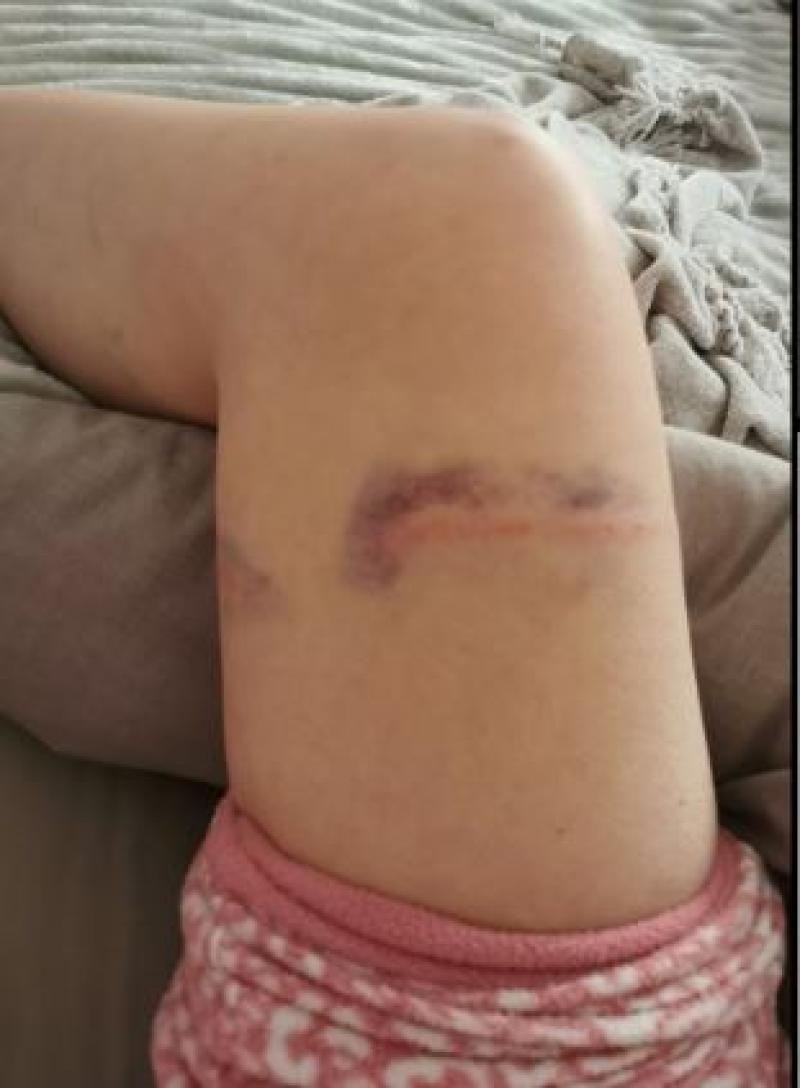 Campaign to be undertaken at Offaly's amenities after recent dog attacks 