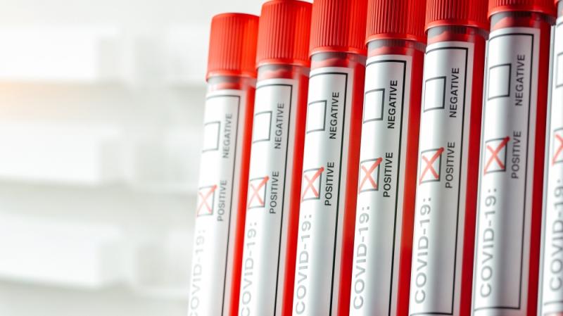 Public Health expert says border not cause of Covid-19 rise