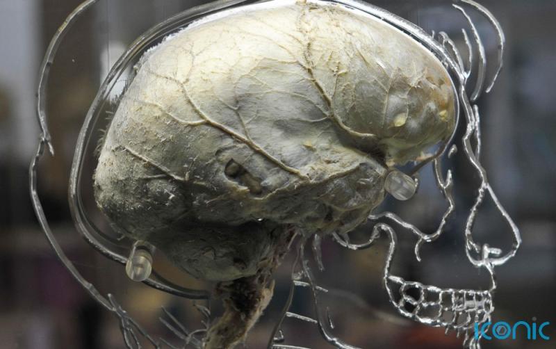 New research suggests memory can be improved by electrical brain stimulation