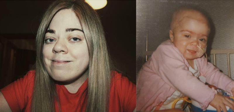 Galway activist says donation of baby’s umbilical cord saved her life