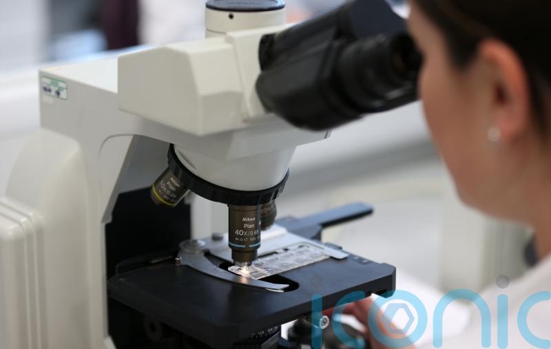 First case of monkeypox identified in Ireland, Health Service Executive says