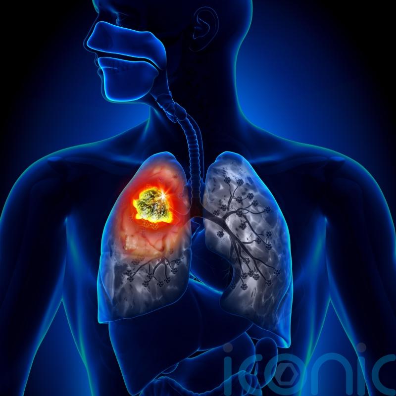 Lung Cancer Awareness Month: Myths about lung cancer everyone needs to stop believing