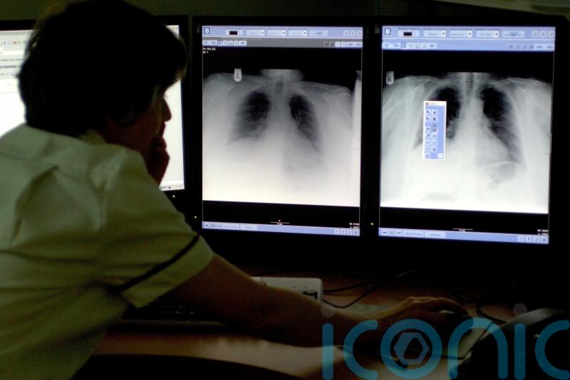 AI to be used more widely in NHS hospitals