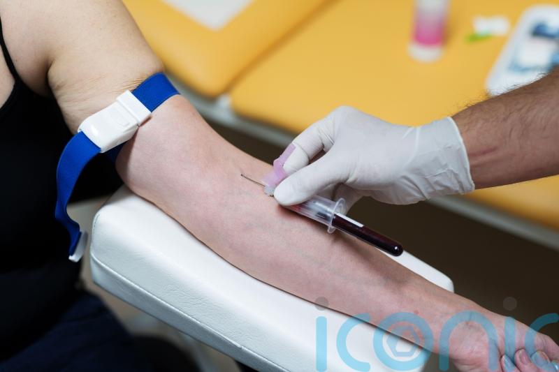 Hepatitis B and C could cause ‘significantly higher cancer risk’ than smoking daily pack of cigarettes