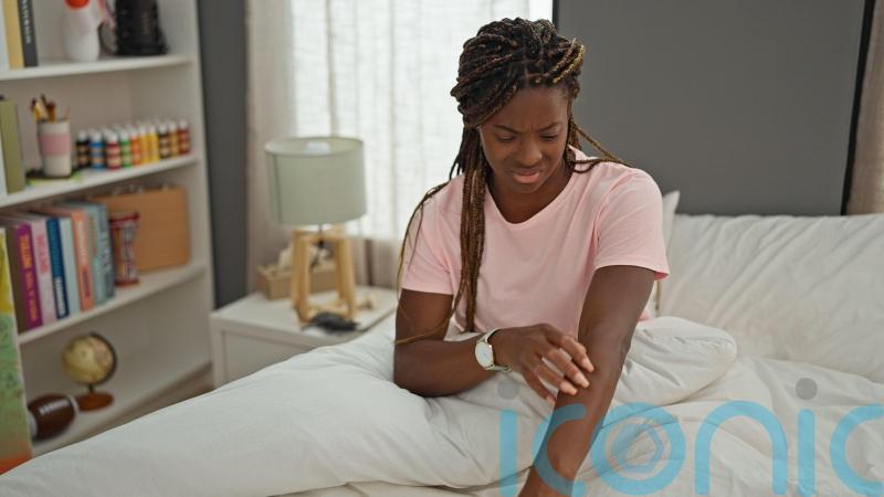 TikTok influencers warn about ‘potent’ steroid cream risks among black women – dermatologist explains the risks