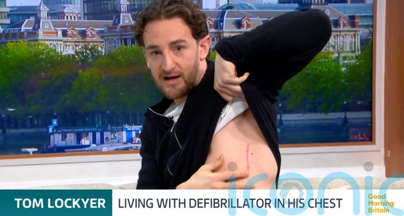 I call it my new little superpower – Tom Lockyer shows defibrillator scar