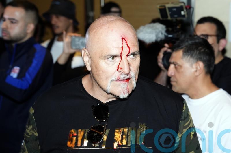 Tyson Fury’s father John suffers cut to head as Oleksandr Usyk fight week begins