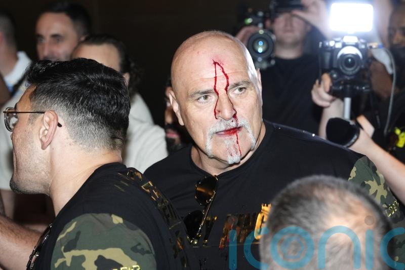 Tyson Fury’s father John cut after clash with member of Oleksandr Usyk entourage
