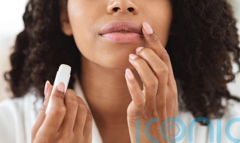 How to get rid of chapped lips this winter
