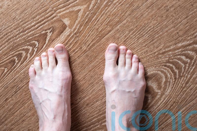 8 things your feet can tell you about your health
