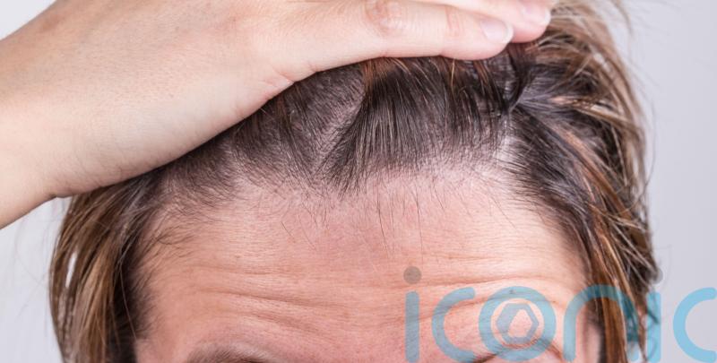 Why your hair is thinning and how to fix it
