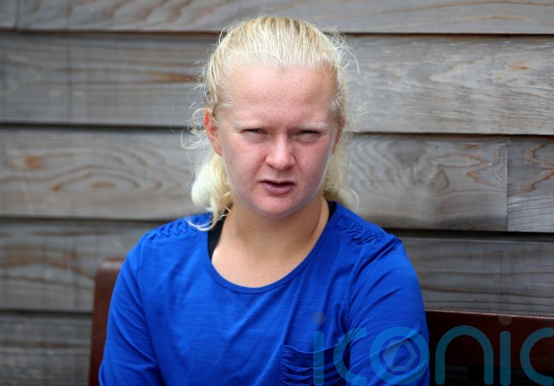 Fran Jones says her ‘heart worked a little too hard’ after on-court collapse