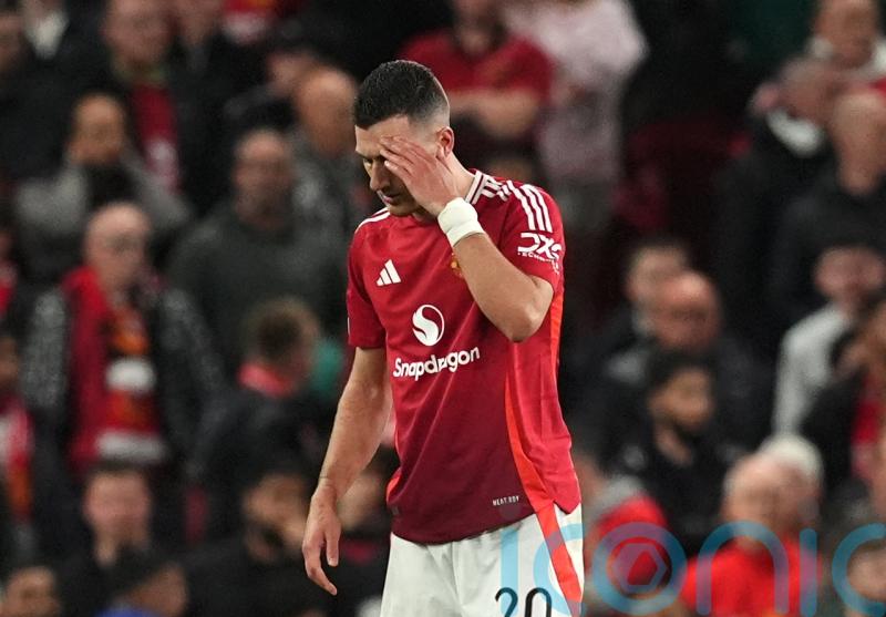 Manchester United’s Diogo Dalot could miss rest of season with calf injury