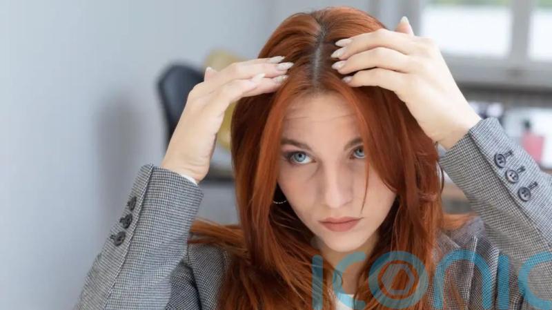 What causes dandruff – and what is the best way to prevent it?