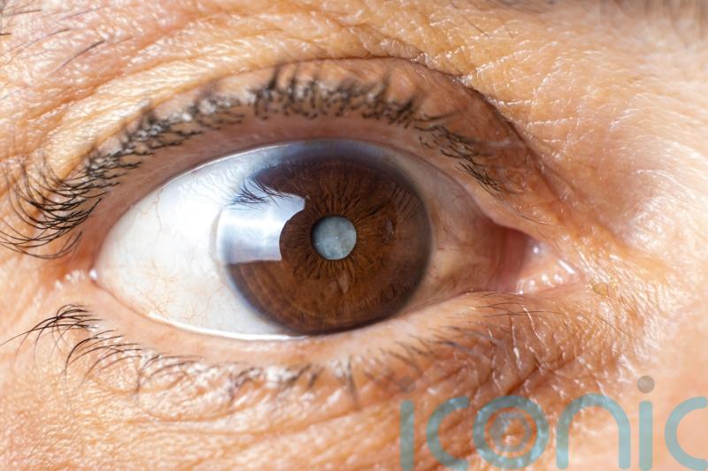 How to spot the early signs of a cataract
